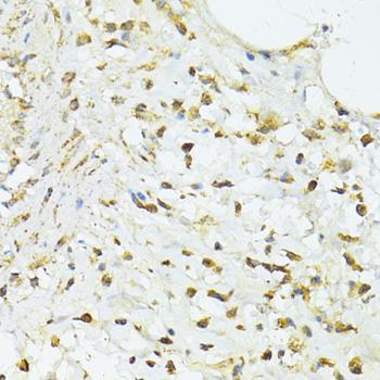 TRIM15 Antibody - Immunohistochemistry of paraffin-embedded Human vermiform appendix using TRIM15 Polyclonal Antibody at dilution of 1:100 (40x lens).