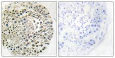 TRIM16 Antibody - Immunohistochemistry analysis of paraffin-embedded human testis, using TRIM16 Antibody. The picture on the right is blocked with the synthesized peptide.