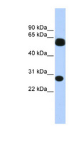 TRIM16 Antibody - TRIM16 antibody Western blot of Fetal Brain lysate. This image was taken for the unconjugated form of this product. Other forms have not been tested.