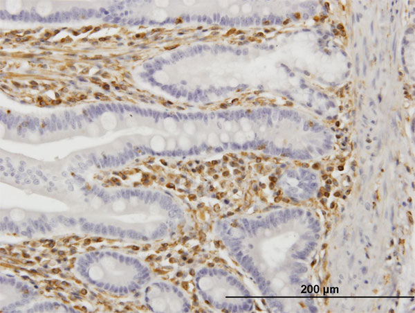 TRIM16 Antibody - Immunoperoxidase of monoclonal antibody to TRIM16 on formalin-fixed paraffin-embedded human small Intestine. [antibody concentration 3 ug/ml]