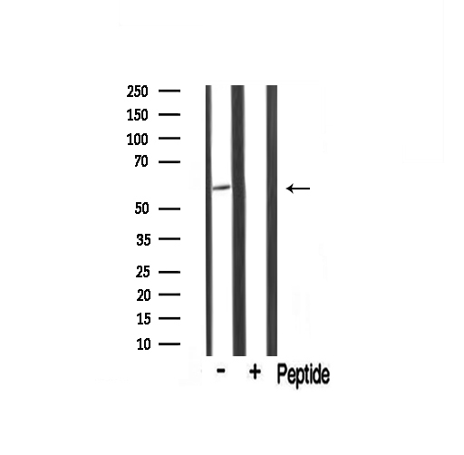 TRIM16 Antibody - Western blot analysis of TRIM16 antibody expression in mouse muscle tissue lysates. The lane on the right is treated with the antigen-specific peptide.