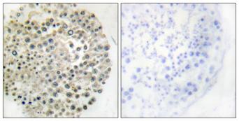 TRIM16 Antibody - Peptide - + Immunohistochemistry analysis of paraffin-embedded human testis tissue, using TRIM16 antibody.