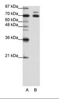 TRIM16 Antibody - A: Marker, B: HepG2 Cell Lysate.  This image was taken for the unconjugated form of this product. Other forms have not been tested.