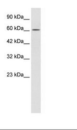 TRIM17 / RNF16 Antibody - Jurkat Cell Lysate.  This image was taken for the unconjugated form of this product. Other forms have not been tested.