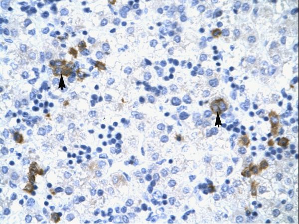 TRIM17 / RNF16 Antibody - Human Liver.  This image was taken for the unconjugated form of this product. Other forms have not been tested.