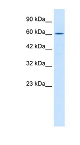 TRIM17 / RNF16 Antibody - TRIM17 antibody Western blot of Jurkat lysate. This image was taken for the unconjugated form of this product. Other forms have not been tested.