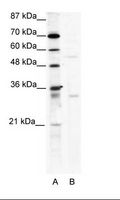 TRIM17 / RNF16 Antibody - A: Marker, B: HepG2 Cell Lysate.  This image was taken for the unconjugated form of this product. Other forms have not been tested.