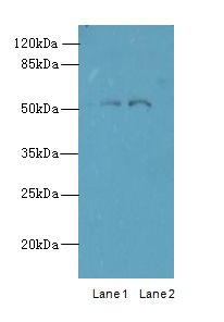 TRIM17 / RNF16 Antibody - Western blot. All lanes: TRIM17 antibody at 1 ug/ml. Lane 1: U87 whole cell lysate. Lane 2: K562 whole cell lysate. Secondary Goat polyclonal to Rabbit IgG at 1:10000 dilution. Predicted band size: 54 kDa. Observed band size: 54 kDa.