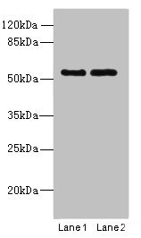 TRIM17 / RNF16 Antibody - Western blot All lanes: TRIM17 antibody at 1µg/ml Lane 1: U87 whole cell lysate Lane 2: K562 whole cell lysate Secondary Goat polyclonal to rabbit IgG at 1/10000 dilution Predicted band size: 55, 40 kDa Observed band size: 55 kDa