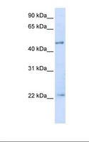 TRIM21 / RO52 Antibody - Transfected 293T cell lysate. Antibody concentration: 1.0 ug/ml. Gel concentration: 12%.  This image was taken for the unconjugated form of this product. Other forms have not been tested.
