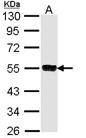 TRIM21 / RO52 Antibody - Sample (30 ug of whole cell lysate). A: Molt-4 . 10% SDS PAGE. RO52 / TRIM21 antibody diluted at 1:1000.