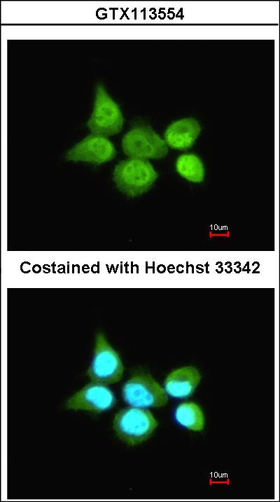 Anti-TRIM21 / RO52 Antibody | Rabbit anti-Human Polyclonal | LSBio