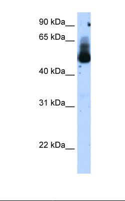 Anti-TRIM21 / RO52 Antibody | Rabbit anti-Human Polyclonal HRP WB | LSBio