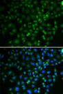 TRIM21 / RO52 Antibody - Immunofluorescence analysis of U2OS cells.