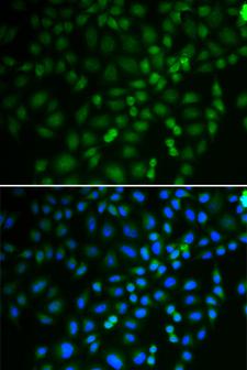 TRIM21 / RO52 Antibody - Immunofluorescence analysis of U2OS cells.
