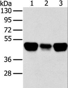 TRIM21 / RO52 Antibody - Western blot analysis of Lovo, A549 and HeLa cell, using TRIM21 Polyclonal Antibody at dilution of 1:400.