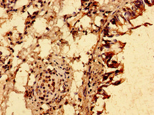 TRIM21 / RO52 Antibody - Immunohistochemistry image of paraffin-embedded human lung tissue at a dilution of 1:100