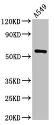TRIM21 / RO52 Antibody - Positive Western Blot detected in A549 whole cell lysate. All lanes: TRIM21 antibody at 2 µg/ml Secondary Goat polyclonal to rabbit IgG at 1/50000 dilution. Predicted band size: 55, 46 KDa. Observed band size: 55 KDa