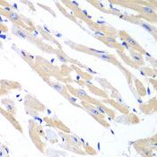 TRIM21 / RO52 Antibody - Immunohistochemistry of paraffin-embedded mouse heart using TRIM21 antibody at dilution of 1:100 (40x lens).