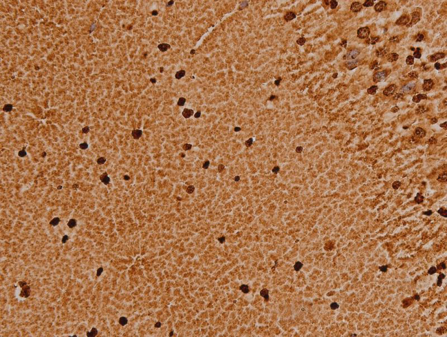 TRIM21 / RO52 Antibody - 1:200 staining human brain tissue by IHC-P. The tissue was formaldehyde fixed and a heat mediated antigen retrieval step in citrate buffer was performed. The tissue was then blocked and incubated with the antibody for 1.5 hours at 22°C. An HRP conjugated goat anti-rabbit antibody was used as the secondary.