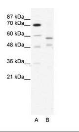 TRIM23 Antibody - A: Marker, B: HepG2 Cell Lysate.  This image was taken for the unconjugated form of this product. Other forms have not been tested.