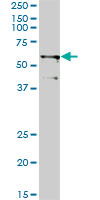 TRIM23 Antibody - TRIM23 monoclonal antibody (M01), clone 2H4. Western Blot analysis of TRIM23 expression in A-431.