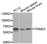 TRIM23 Antibody - Western blot analysis of extracts of various cell lines.