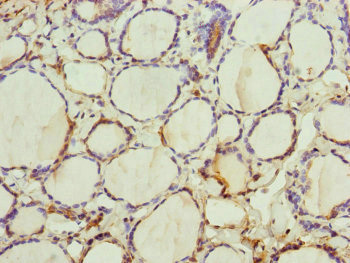 TRIM23 Antibody - Immunohistochemistry of paraffin-embedded human thyroid tissue at dilution of 1:100
