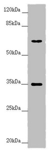 TRIM23 Antibody - Western blot All Lanes:TRIM23 antibody at 4.55 ug/ml+ Raw264.7 whole cell lysate Secondary Goat polyclonal to rabbit IgG at 1/10000 dilution Predicted band size: 65,64,62 kDa Observed band size: 64,35 kDa