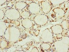 TRIM23 Antibody - Immunohistochemistry of paraffin-embedded human thyroid tissue at dilution of 1:100