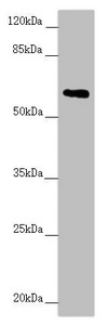 TRIM23 Antibody - Western blot All Lanes:TRIM23 antibody at 2.67 ug/ml+ Raw264.7 whole cell lysate Secondary Goat polyclonal to rabbit IgG at 1/10000 dilution Predicted band size: 65,64,62 kDa Observed band size: 64 kDa