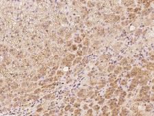 TRIM23 Antibody - Immunochemical staining of human TRIM23 in human adrenal gland with rabbit polyclonal antibody at 1:500 dilution, formalin-fixed paraffin embedded sections.