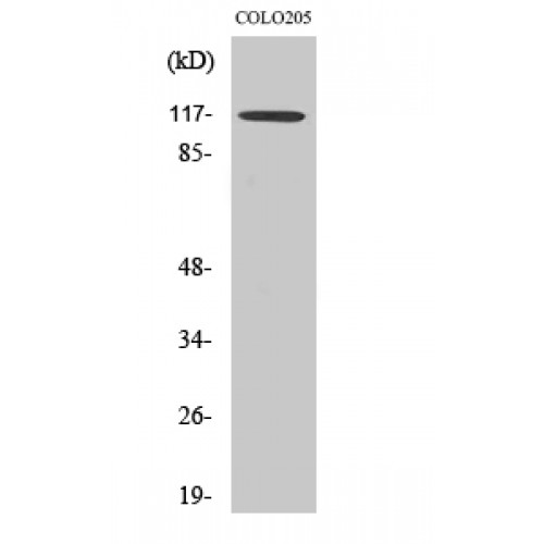 TRIM24 / TIF1 Antibody - Western blot of TIF1alpha antibody