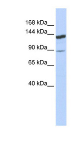 TRIM24 / TIF1 Antibody - TRIM24 antibody Western blot of HeLa lysate. This image was taken for the unconjugated form of this product. Other forms have not been tested.