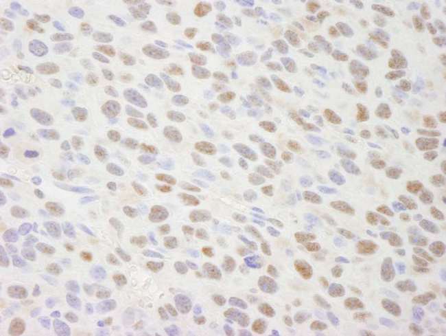 TRIM24 / TIF1 Antibody - Detection of Mouse TIF1 Alpha / TRIM24 by Immunohistochemistry. Sample: FFPE section of mouse squamous cell carcinoma. Antibody: Affinity purified rabbit anti-TIF1 Alpha/TRIM24 used at a dilution of 1:250.