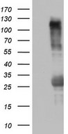 TRIM24 / TIF1 Antibody - E.coli lysate (left lane) and E.coli lysate expressing Human recombinant protein fragment (right lane) to amino acids 706-1016 of human TRIM24 (NP_003843).