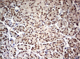 TRIM24 / TIF1 Antibody - IHC of paraffin-embedded Human pancreas tissue using anti-TRIM24 mouse monoclonal antibody. (Heat-induced epitope retrieval by 10mM citric buffer, pH6.0, 120°C for 3min).