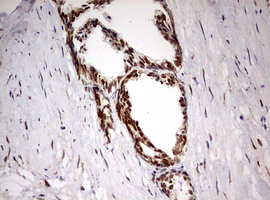 TRIM24 / TIF1 Antibody - IHC of paraffin-embedded Human prostate tissue using anti-TRIM24 mouse monoclonal antibody. (Heat-induced epitope retrieval by 10mM citric buffer, pH6.0, 120°C for 3min).