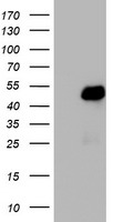 TRIM24 / TIF1 Antibody - HEK293T cells were transfected with the pCMV6-ENTRY control (Left lane) or pCMV6-ENTRY TRIM24 (Right lane) cDNA for 48 hrs and lysed. Equivalent amounts of cell lysates (5 ug per lane) were separated by SDS-PAGE and immunoblotted with anti-TRIM24.