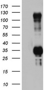TRIM24 / TIF1 Antibody - HEK293T cells were transfected with the pCMV6-ENTRY control (Left lane) or pCMV6-ENTRY TRIM24 (Right lane) cDNA for 48 hrs and lysed. Equivalent amounts of cell lysates (5 ug per lane) were separated by SDS-PAGE and immunoblotted with anti-TRIM24.