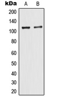 TRIM24 / TIF1 Antibody - Western blot analysis of TIF1 alpha expression in MCF7 (A); HeLa (B) whole cell lysates.