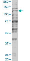 TRIM24 / TIF1 Antibody - TRIM24 monoclonal antibody (M01), clone 2F2. Western blot of TRIM24 expression in HeLa NE.