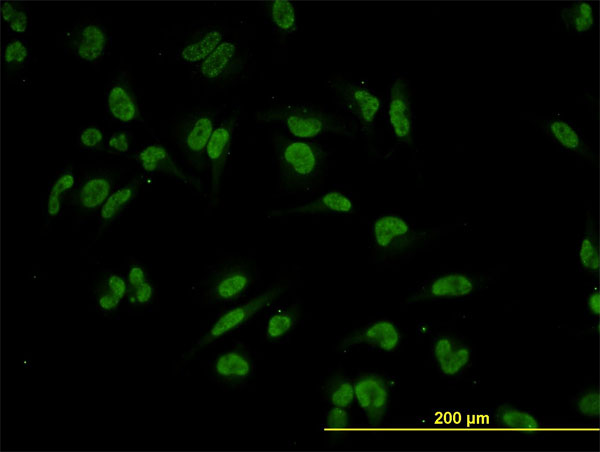 TRIM24 / TIF1 Antibody - Immunofluorescence of monoclonal antibody to TRIM24 on HeLa cell. [antibody concentration 10 ug/ml]