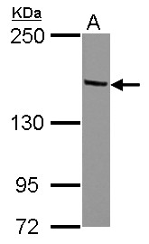 TRIM24 / TIF1 Antibody - Sample (30 ug of whole cell lysate) A: HeLa 5% SDS PAGE TRIM24 antibody diluted at 1:1000