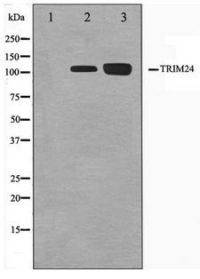 TRIM24 / TIF1 Antibody - Western blot of Jurkat and K562 cell lysate using TRIM24 Antibody