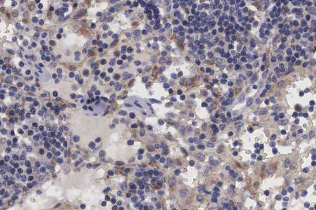 TRIM24 / TIF1 Antibody - 1:100 staining human lymph node tissue by IHC-P. The tissue was formaldehyde fixed and a heat mediated antigen retrieval step in citrate buffer was performed. The tissue was then blocked and incubated with the antibody for 1.5 hours at 22°C. An HRP conjugated goat anti-rabbit antibody was used as the secondary.