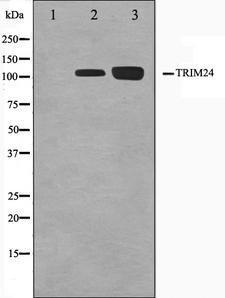 TRIM24 / TIF1 Antibody - Western blot analysis on Jurkat and K562 cell lysates using TRIM24 antibody. The lane on the left is treated with the antigen-specific peptide.
