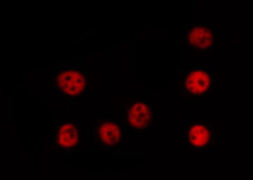 TRIM24 / TIF1 Antibody - Staining COLO205 cells by IF/ICC. The samples were fixed with PFA and permeabilized in 0.1% Triton X-100, then blocked in 10% serum for 45 min at 25°C. The primary antibody was diluted at 1:200 and incubated with the sample for 1 hour at 37°C. An Alexa Fluor 594 conjugated goat anti-rabbit IgG (H+L) Ab, diluted at 1/600, was used as the secondary antibody.