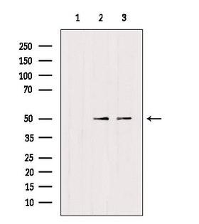 TRIM24 / TIF1 Antibody - Western blot analysis of extracts of various samples using TRIM24 antibody. Lane 1: 293 treated with blocking peptide. Lane 2: 293; Lane 3: HeLa;