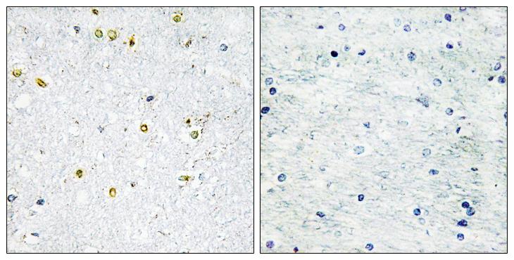 TRIM24 / TIF1 Antibody - Peptide - + Immunohistochemistry analysis of paraffin-embedded human brain tissue using TRIM24 antibody.